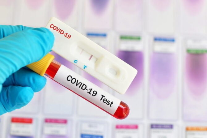 Экспресс-тест на наличие антител к COVID-19
